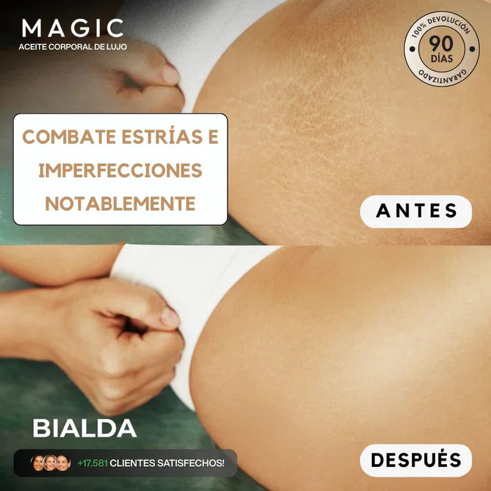 Besque™ Magic Body Oil - Para estrías, flacidez y piel seca