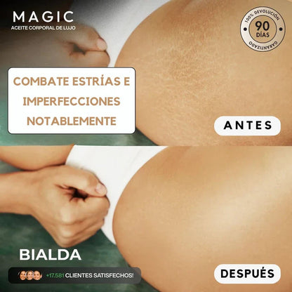 Besque™ Magic Body Oil - Para estrías, flacidez y piel seca