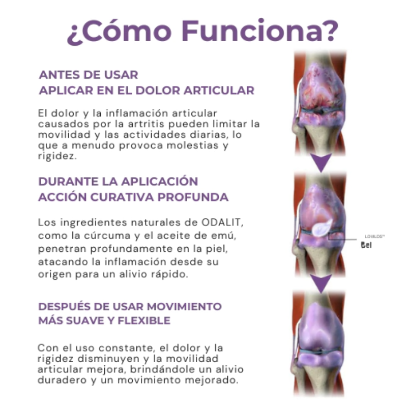 ODALIT ® Gel de masaje calmante para artritis - Chau dolor, hola bienestar en 3 minutos